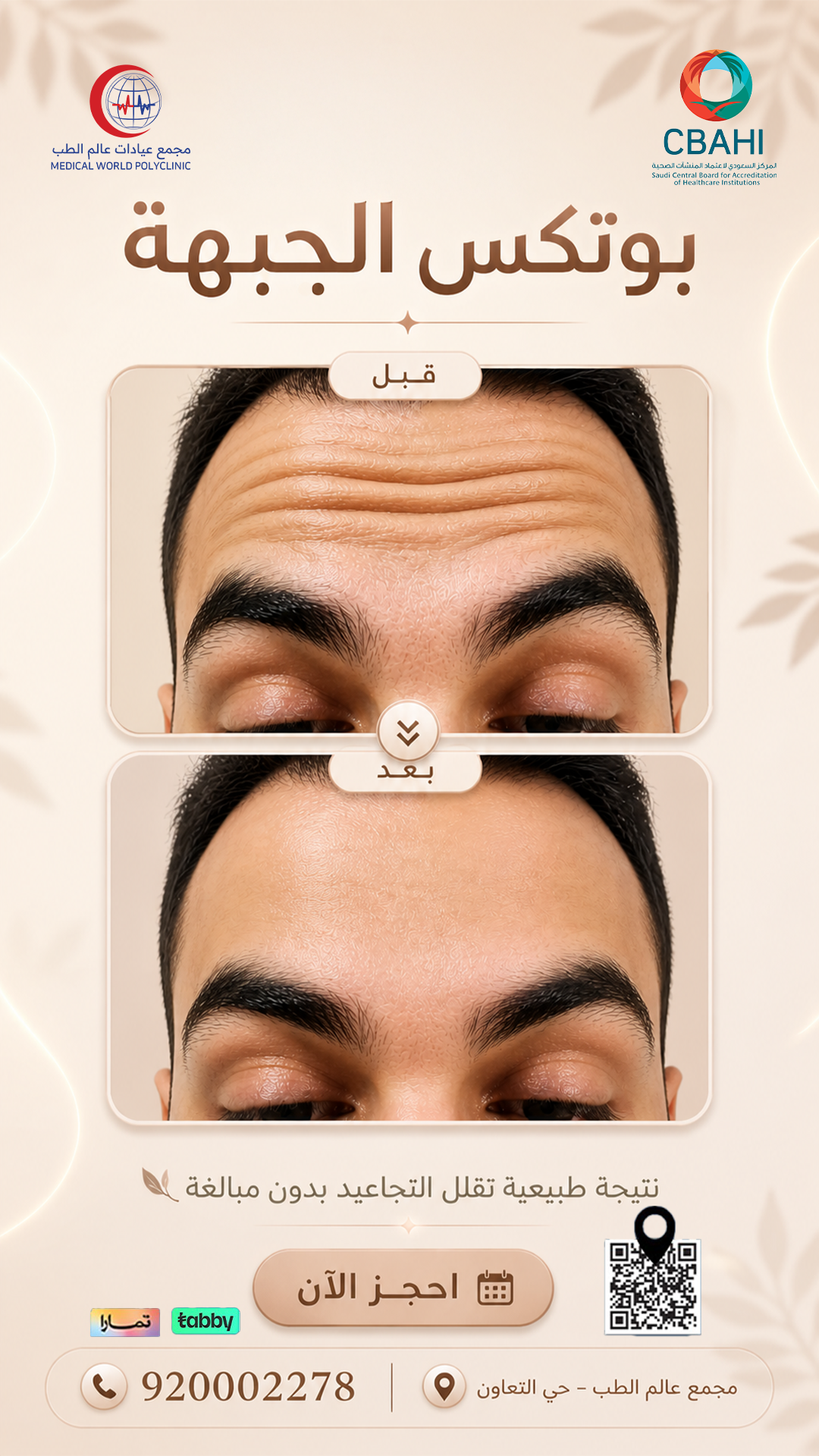 عروض البوتوكس