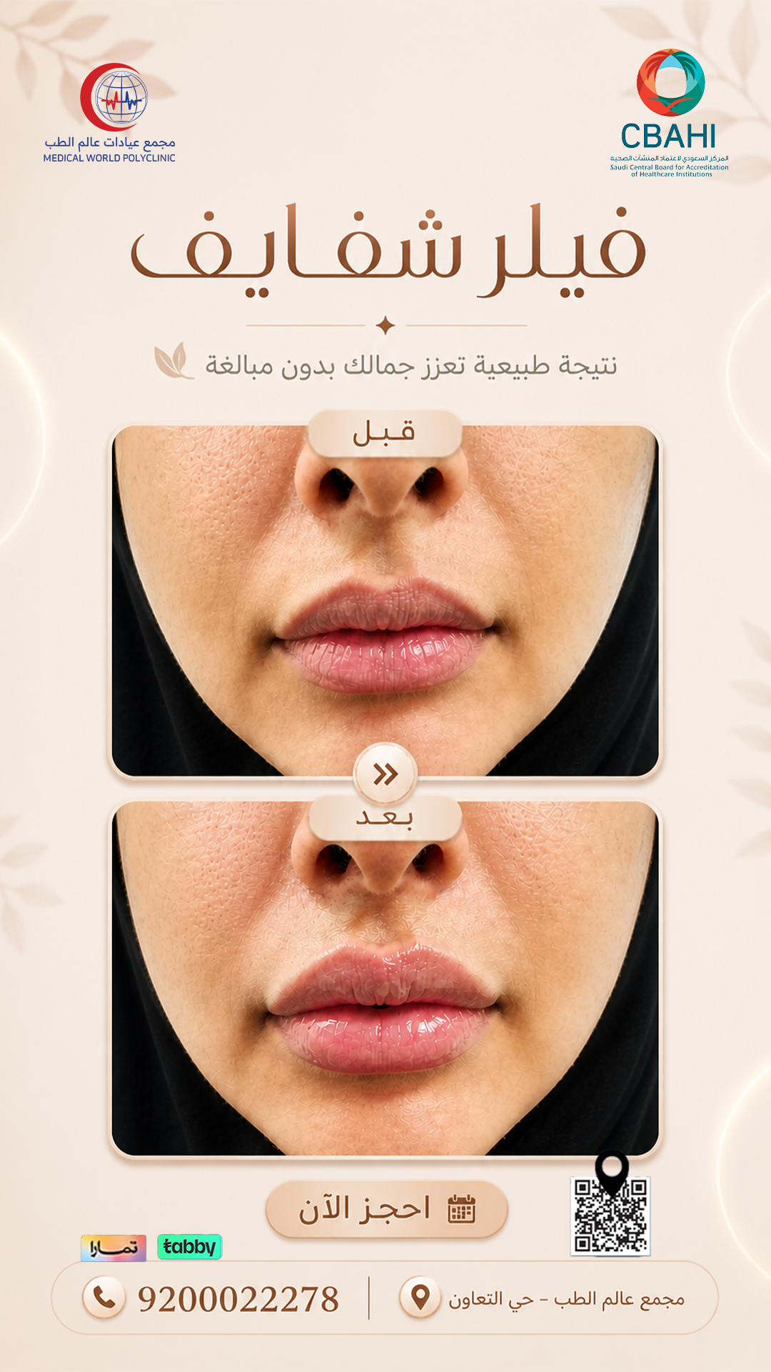 عروض الفيلر
