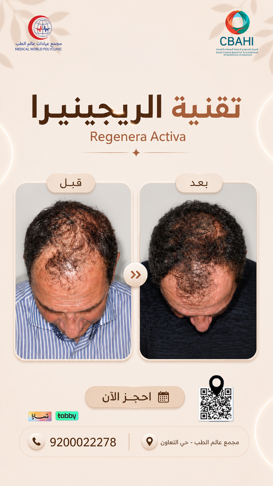 عروض ريجينرا